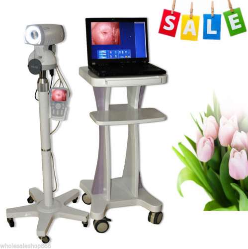 SONY Camera 830,000 Pixels CCD + Digital Video Electronic Colposcope Endo Fast D